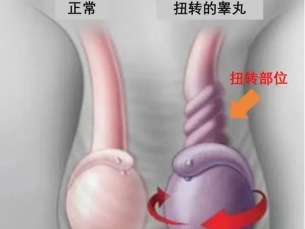 “蛋疼”無小事，家有男娃需注意！